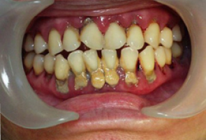 Gerringon Dental